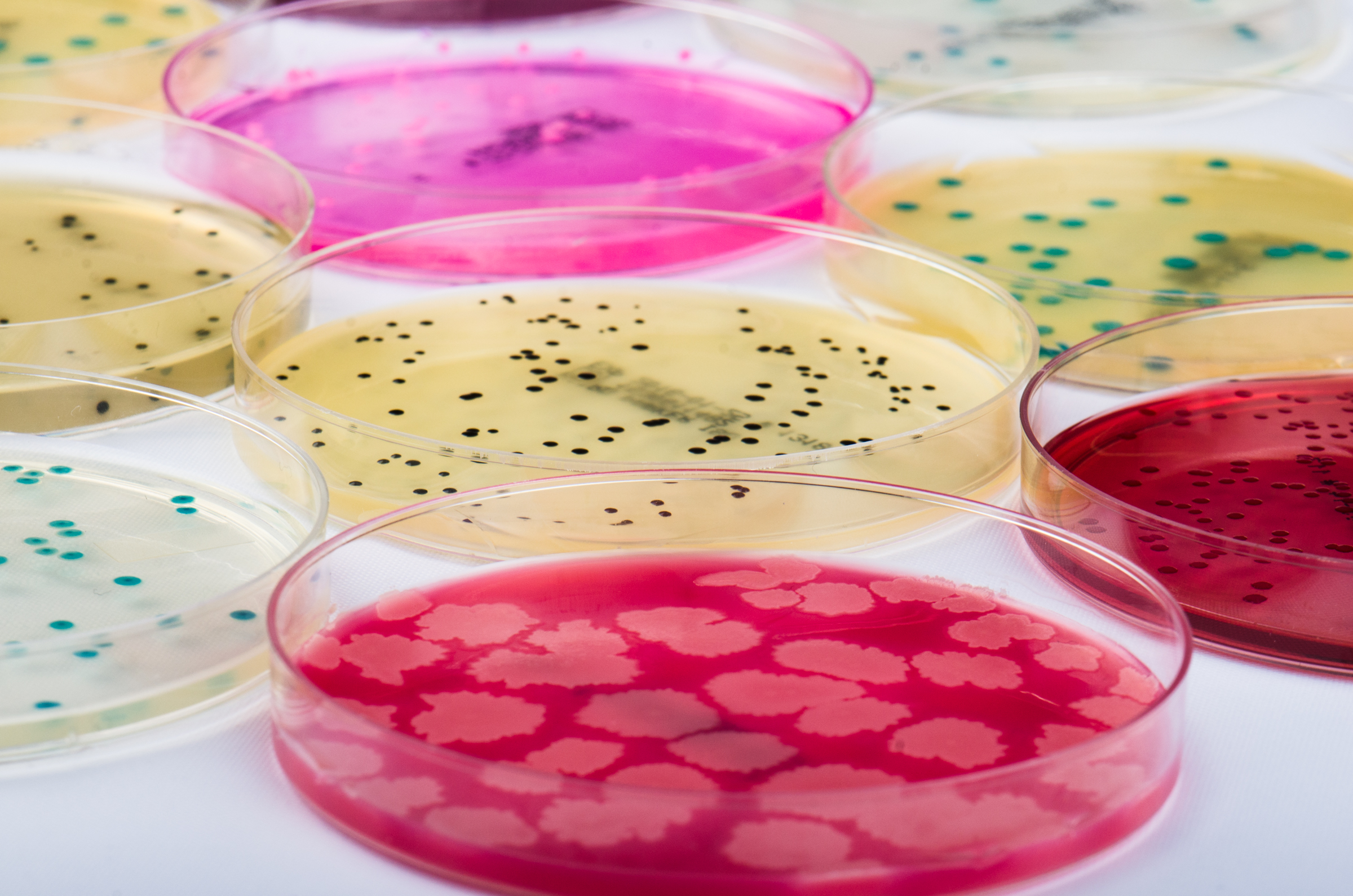 Procescontrole van microbiologische analyses is essentieel voor kwaliteitsborging