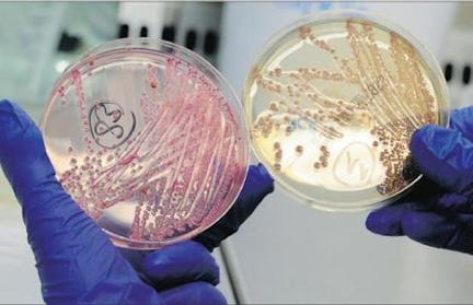 On topic: Wat betekent E. coli voor de voedselveiligheid?