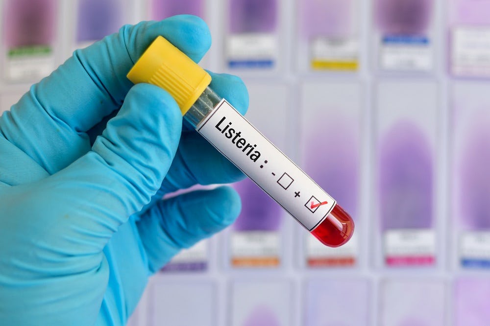 De rol van vochtbeheersing bij bestrijding Listeria