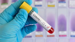 De rol van vochtbeheersing bij bestrijding Listeria