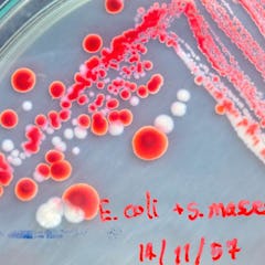 E.coli (STEC/ EHEC)