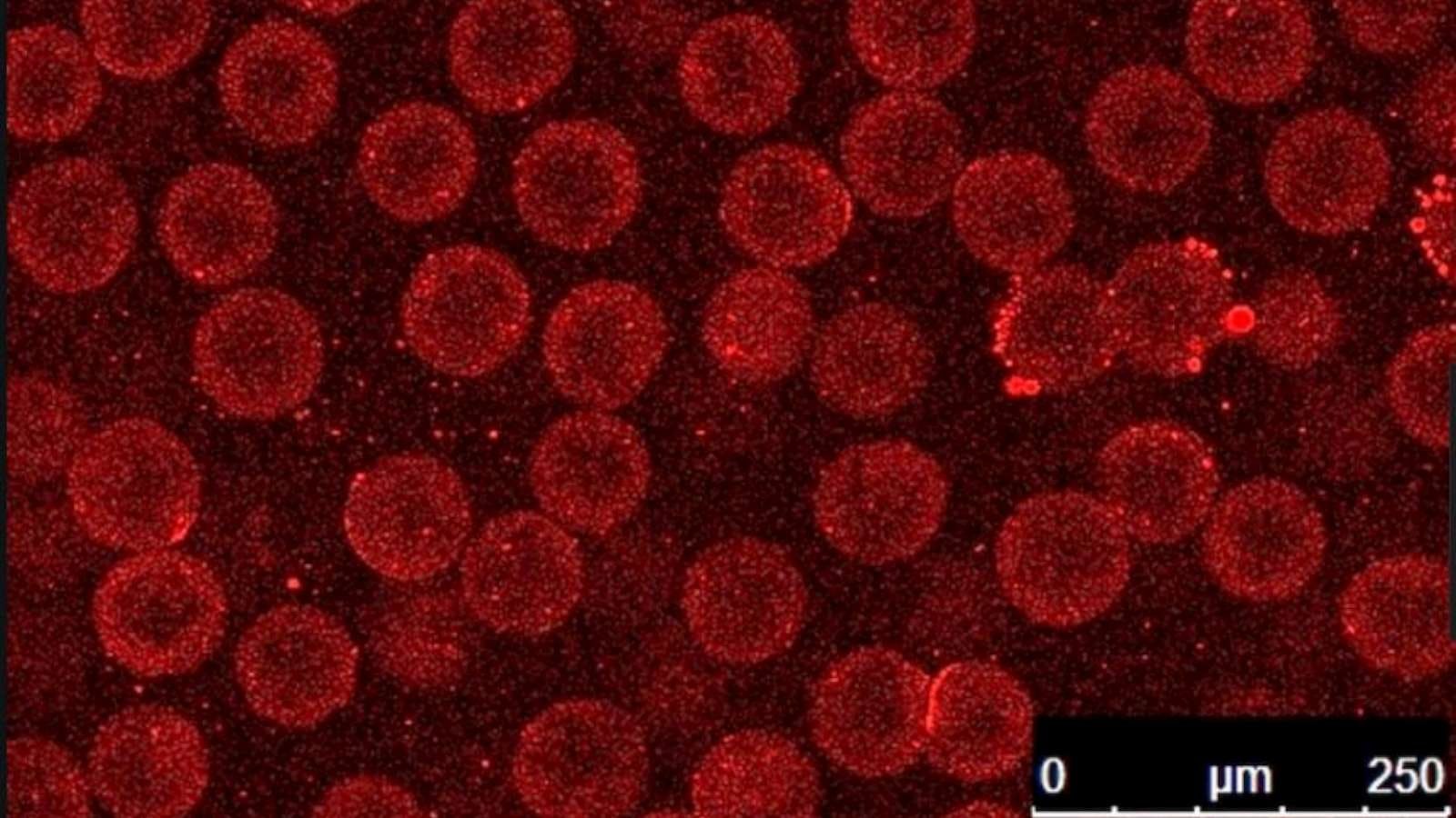 The Wyss’ sugar-to-fiber enzyme is encapsulated into spherical nanoparticles that protect it during food manufacturing processes, then break open in the human gut to release their cargo. Credit: Wyss Institute at Harvard University