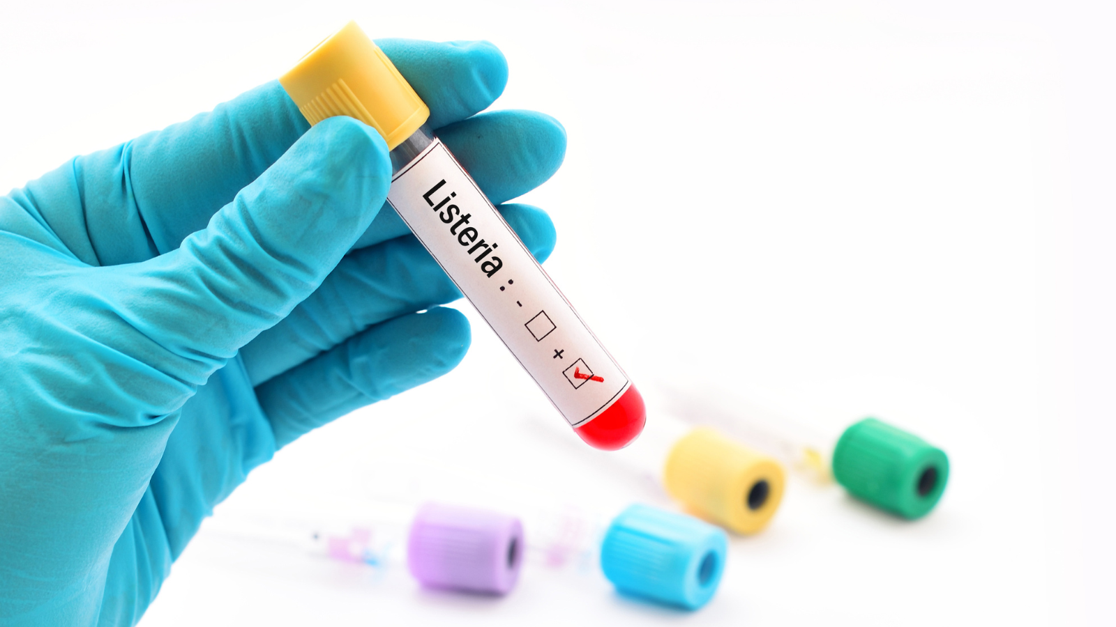 De rol van vochtbeheersing bij bestrijding Listeria en Campylobacter 