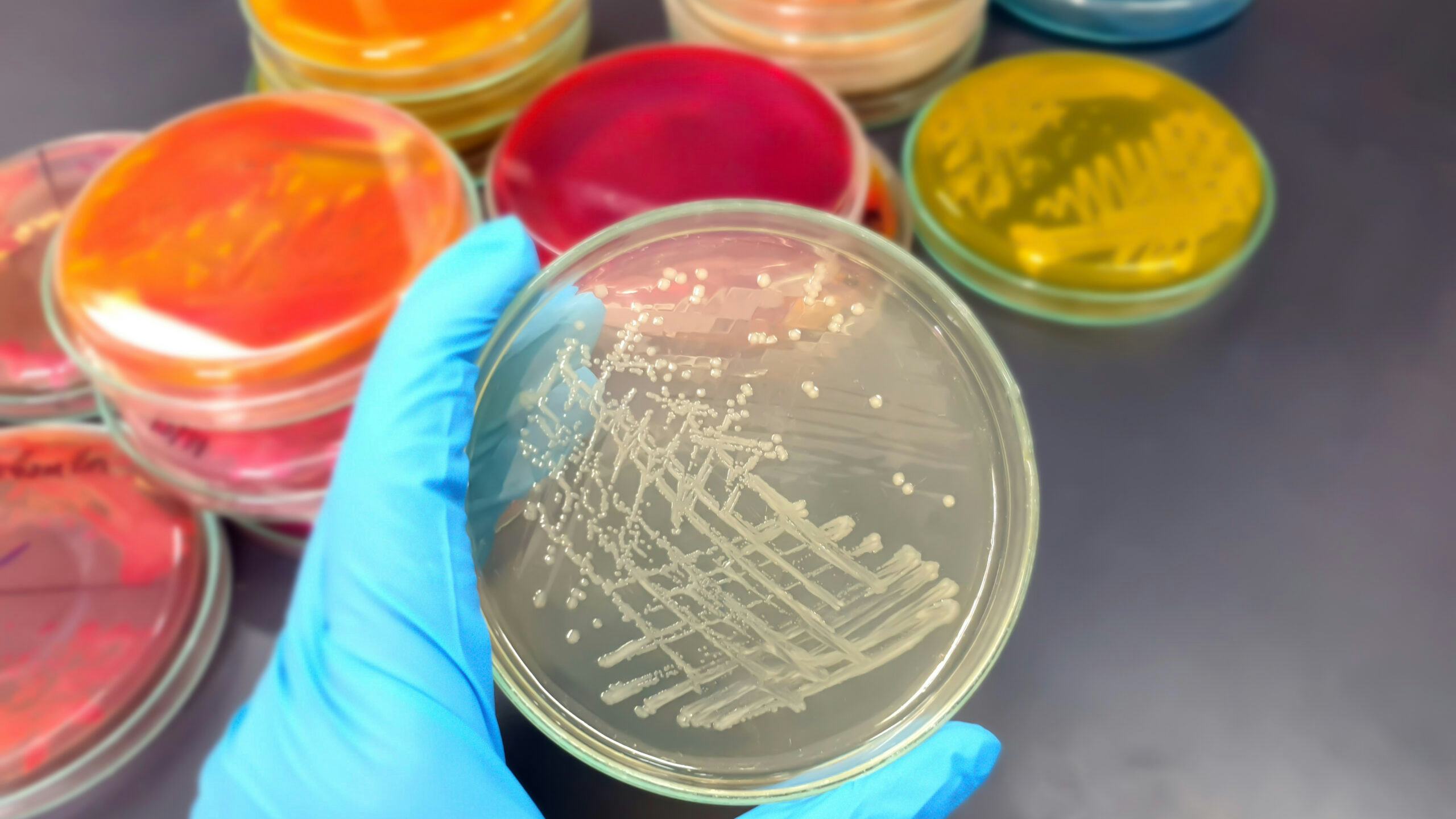 Meer over levensmiddelenmicrobiologie: