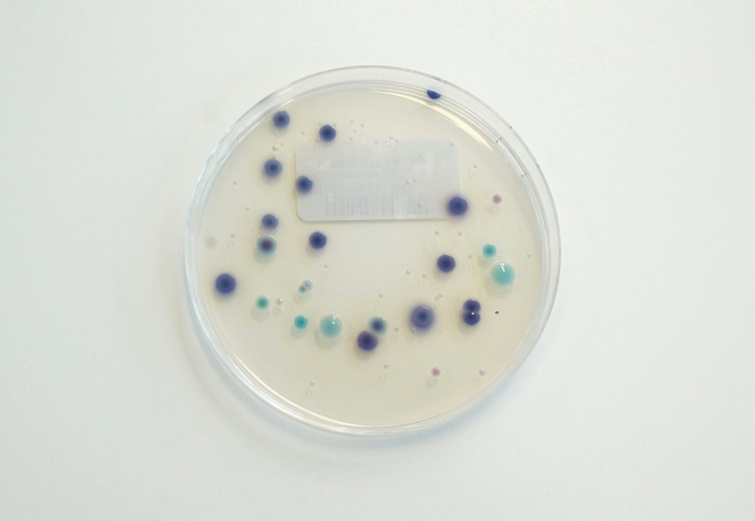 RAPID’E. coli 2 agar