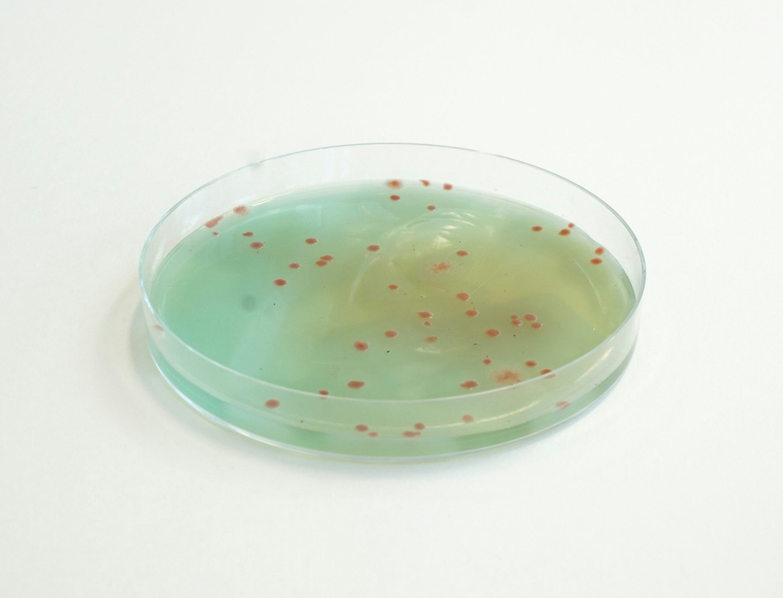 RAPID’B.cereus agar