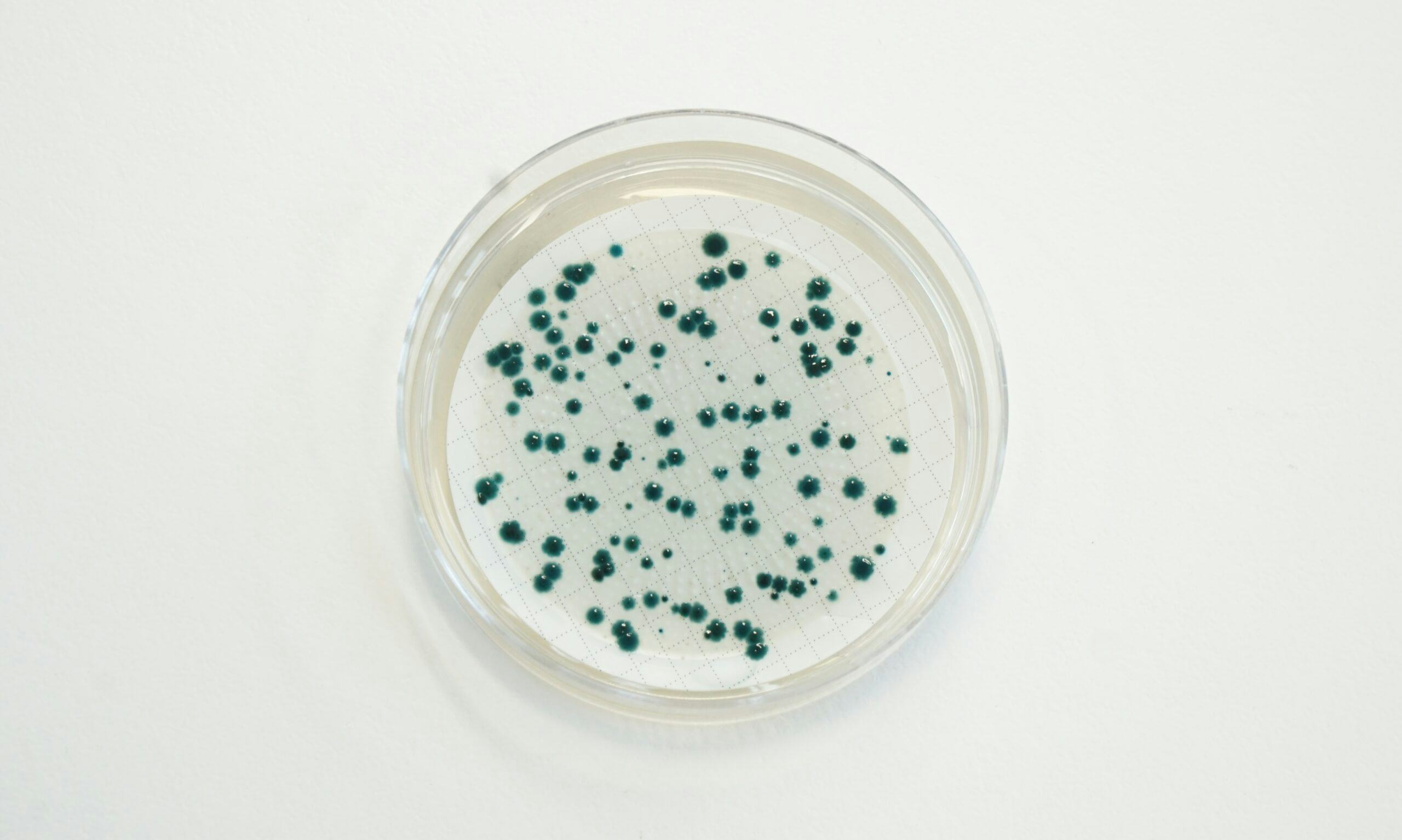 RAPID’P.aeruginosa agar