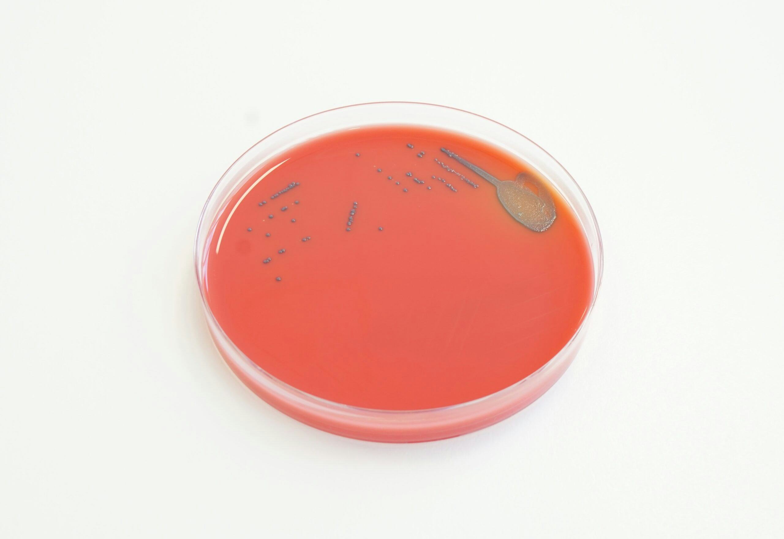 RAPID’L.mono agar (detectie)